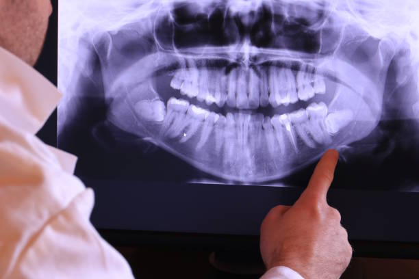 Best Emergency Treatment for Toothache in Timberlane, IL