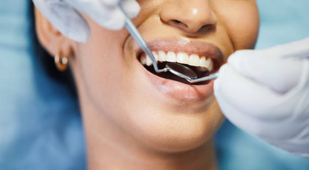 Best Emergency Tooth Extraction in Timberlane, IL