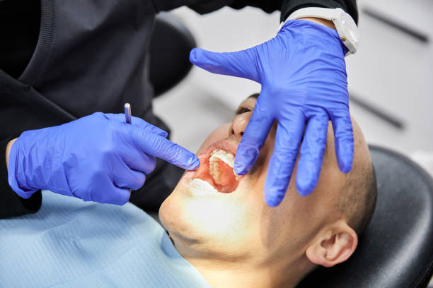 Best Emergency Root Canal Treatment in Timberlane, IL